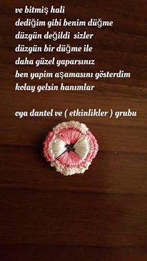 dugme-oyasi-yapimi-resimli-anlatim-3